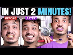 Shocking Results! 😱 Perfora Purple Whitening Serum Tested on Yellow Stains 🟣