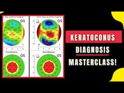 Keratoconus Diagnosis Masterclass 🔍