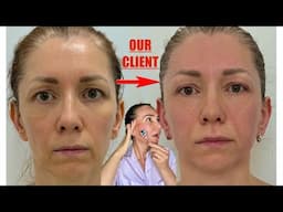 It’s a Game Changer | 10 Years YOUNGER WITH This MASSAGE