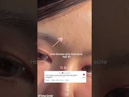 Viral way Koreans treat tiny pimples (Q&A) #shorts