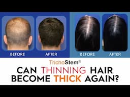 How Thinning Hair can Become Thicker Hair