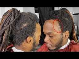 I TRIED to Fix His NONEXISTENT HAIRLINE!