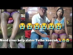 6909904587 || Ac/No.39689306005 / ifsc. SBIN0017216 | Need your help Toihe konyak