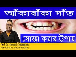 আঁকা  বাঁকা  দাঁত সোজা  করার  উপায় ||Teeth Braces Treatment ||দাঁত না ফেলে আঁকাবাঁকা দাঁতের চিকিৎসা
