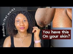 HOW TO GET RID OF TEXTURED SKIN✨best products for smoothing skin texture.#smoothskin #clearskin