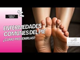 Cuidado de los Pies: Enfermedades Comunes y Cómo Prevenirlas. | Consulta médica.