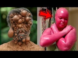 8 MOST Unusual People With UNBELIEVABLE Skin Conditions