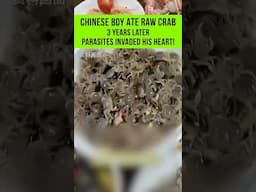 Chinese Boy Ate Raw Crab—3 Years Later, Parasites Invaded His Heart! ⚠️🦀