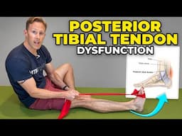 Posterior Tibial Tendon Dysfunction Exercises