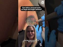 Can you remove bright tattoos? #removery #tattooremoval