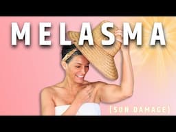 A Master Esthetician's Solution to Melasma | Peaches Skin Care