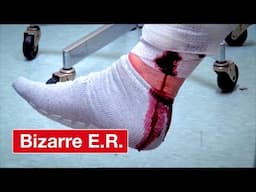 Varicose Vein Wont Stop Bleeding - Bizarre ER