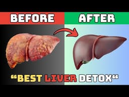 #1 Absolute Best Way to Reverse Fatty Liver, Naturally | NAFLD Treatment