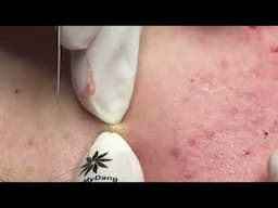 Linhmydangspa ( 7/5/2025)