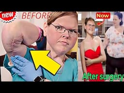1000-Lb Sisters: Tammy Slaton's Incredible Face Lift Results Could Be Her Biggest Milestone Yet