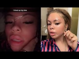 "I F*ck Up Big Time" Latto Burns Her Face After Using Too Much Retinol