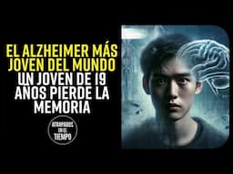 ¿Alzheimer en un joven de 19 años?