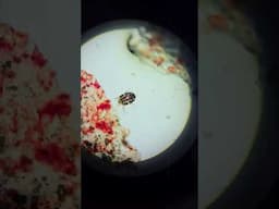 NASTY Rabbit Ear Mites (Psoroptes cuniculi) #bunny #mites #cats