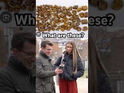 Doctor explains Gallstones … #shorts