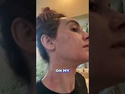 Day 5 of my peel creation. This hurts!! #antiaging