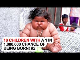 10 Children With A 1 In 1,000,000 Chance Of Being Born! #2