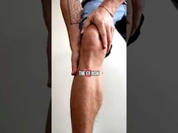 Survives blood clot at 29 years old @stoptheclot #bloodclot #dvt #stoptheclot #healthanxiety