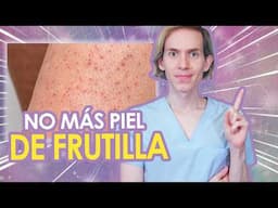 Queratosis pilaris (Piel de gallina o frutilla) - QUÉ ES y CÓMO ELIMINARLA  - Simon Scarano