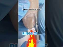have rings of fire? it might be from your Amazon bits 👀 #nailtech #nailtechnician #nails