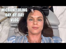 Microneedling Recovery Vlog: Day-by-Day Healing, Results & Skincare Tips