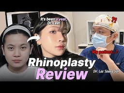 How NANA’s Rhinoplasty Changed My Nose: 1 Year Later!