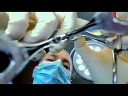 ASMR Eye Surgery & Prosthetic Eye Fitting | Eye Exam, Color Matching