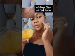 No More Dark Spots On The Face #DarkSpots #skincare #beauty