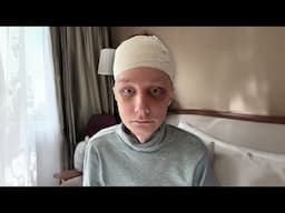 *RESULTS* Before and After MORE Facial Feminisation Surgery in South Korea