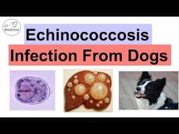 Echinococcosis (Disease From Dogs): How You Get Sick, Signs and Symptoms, Diagnosis, Treatment