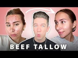 Beef Tallow For Your Skin… Is It Worth The Risks?