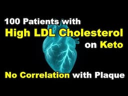 High LDL, No Correlation with Plaque – Explosive New Findings