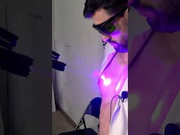Used a High-Powered Laser… My Skin Exploded 😵‍💥🔥 #shorts #funny #comedy
