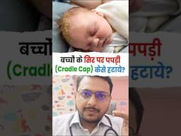 बच्चो के सिर पर पपड़ी (cradle cap) कैसे हटाये