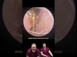 That Peel Though… 😲 Epic Wax Lift from the Eardrum!