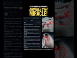 CYM TESTIMONY! The cyst wouldn’t stop bleeding… until it vanished. No meds. No surgery. Just prayer.