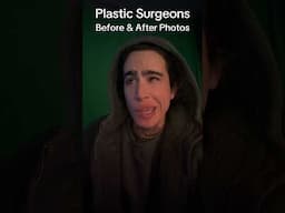 Your Surgeon should have Before & After Photos