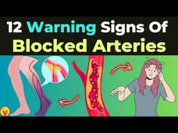 12 Signs Of Artery Blockages You Shouldn't Ignore | Silent Signs of Blocked Arteries | VisitJoy