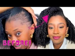FIX Your POSTPARTUM Hair Loss in 3 Easy Steps | My Story