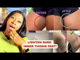 Two Effective Ways to Get rid of Dark inner thighs permanently.