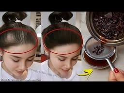 Spray it on your hair for 2 days,🌾Hair grows like crazy and doesn't fall out,🧅grandmother recipe!