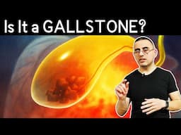 Gallbladder Attack or Something Else? What Your Upper Right Pain Means!