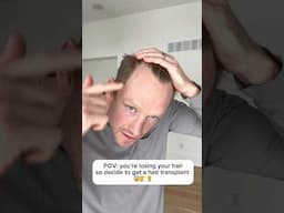 Ahhh I NEVER thought I’d be losing my hair 😱😭But the road to a new hair line starts now! #hairloss
