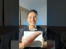 Cuidado con estas lesiones 🚨 #eczema #drwilsondelgado #tips #cuidadodelapiel