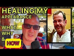 HEALING MY APPEARANCE- How I Look 10 Years Younger.