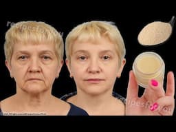 If you are over 50 years, apply it on the wrinkles, and they will disappear,🤯Collagen stimulation
